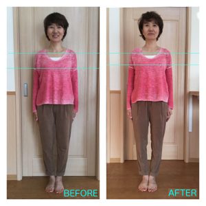 パワージュエルセラピーボディコースの施術前後比較