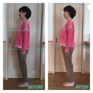 パワージュエルセラピーボディコースの施術前後比較