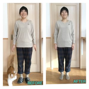 パワージュエルボディ系施術前後比較