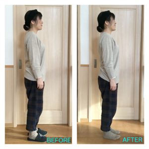 パワージュエルボディ系施術前後比較