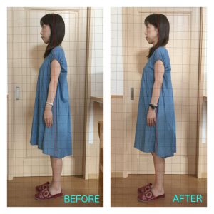 パュエルセラピー施術前後比較