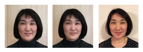 パワージュエルの美容系施術前後比較