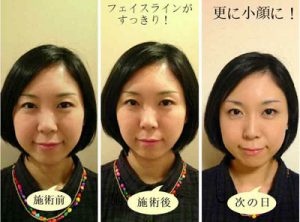 パワージュエルセラピー効果