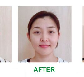 パワージュエルビフォーアフター