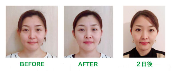 パワージュエルビフォーアフター