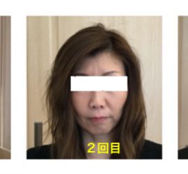 パワージュエルビフォーアフター