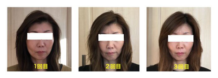 パワージュエルビフォーアフター