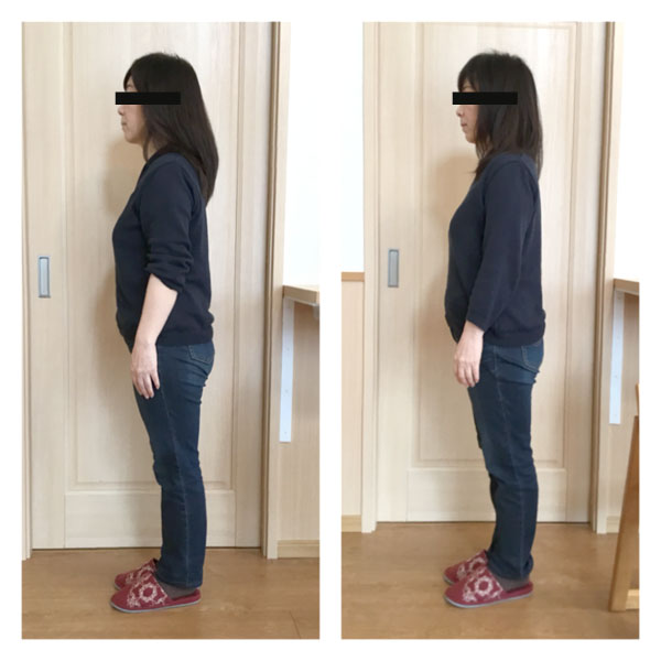 パワージュエル整体施術例