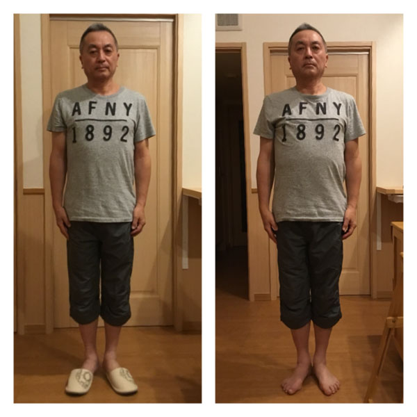 パワージュエルビフォーアフター前向き