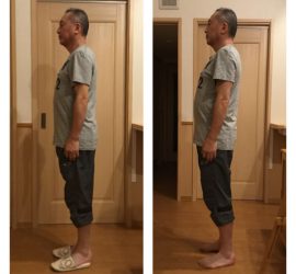 パワージュエルビフォーアフター横向き