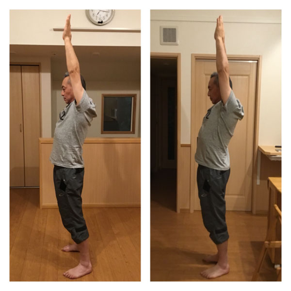 パワージュエルビフォーアフター挙手横向き