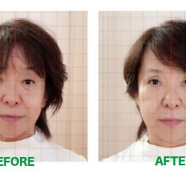 パワージュエルビフォーアフター